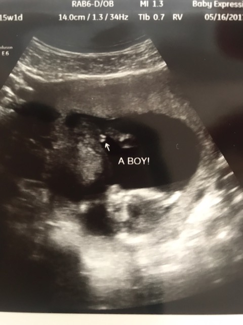 Ultrasound